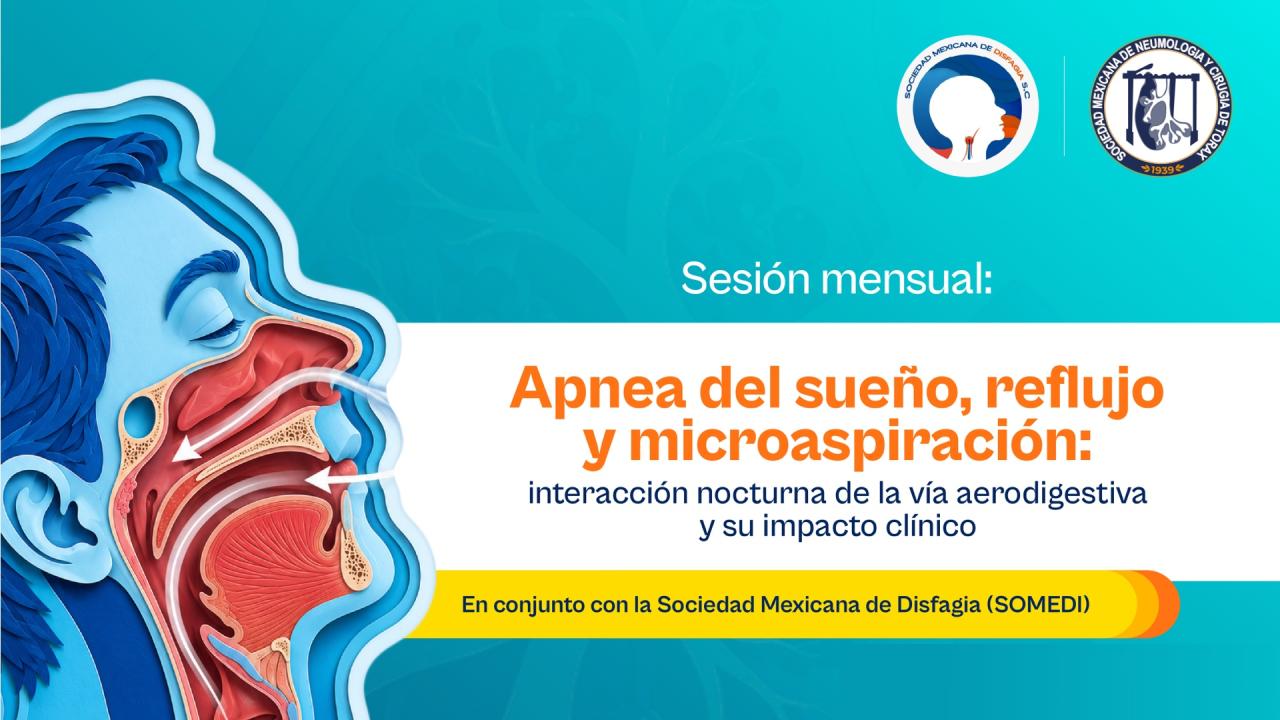 Apnea del sueño, reflujo y microaspiración: interacción nocturna de la vía aerodigestiva y su impacto clínico