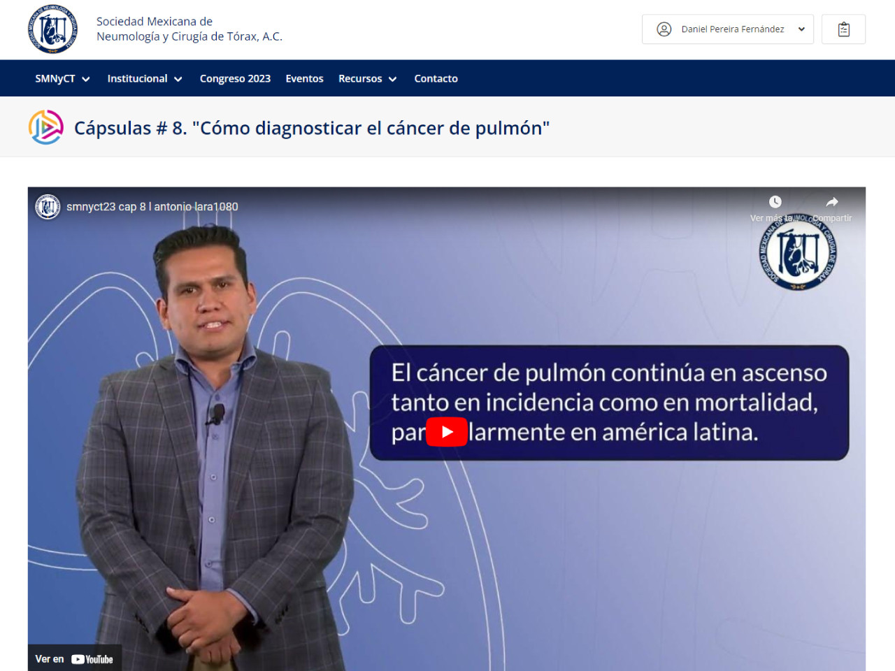 Cápsulas # 8. "Cómo diagnosticar el cáncer de pulmón"