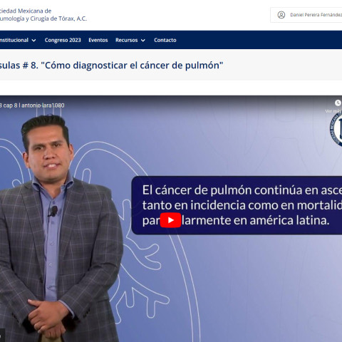 Cápsulas # 8. "Cómo diagnosticar el cáncer de pulmón"