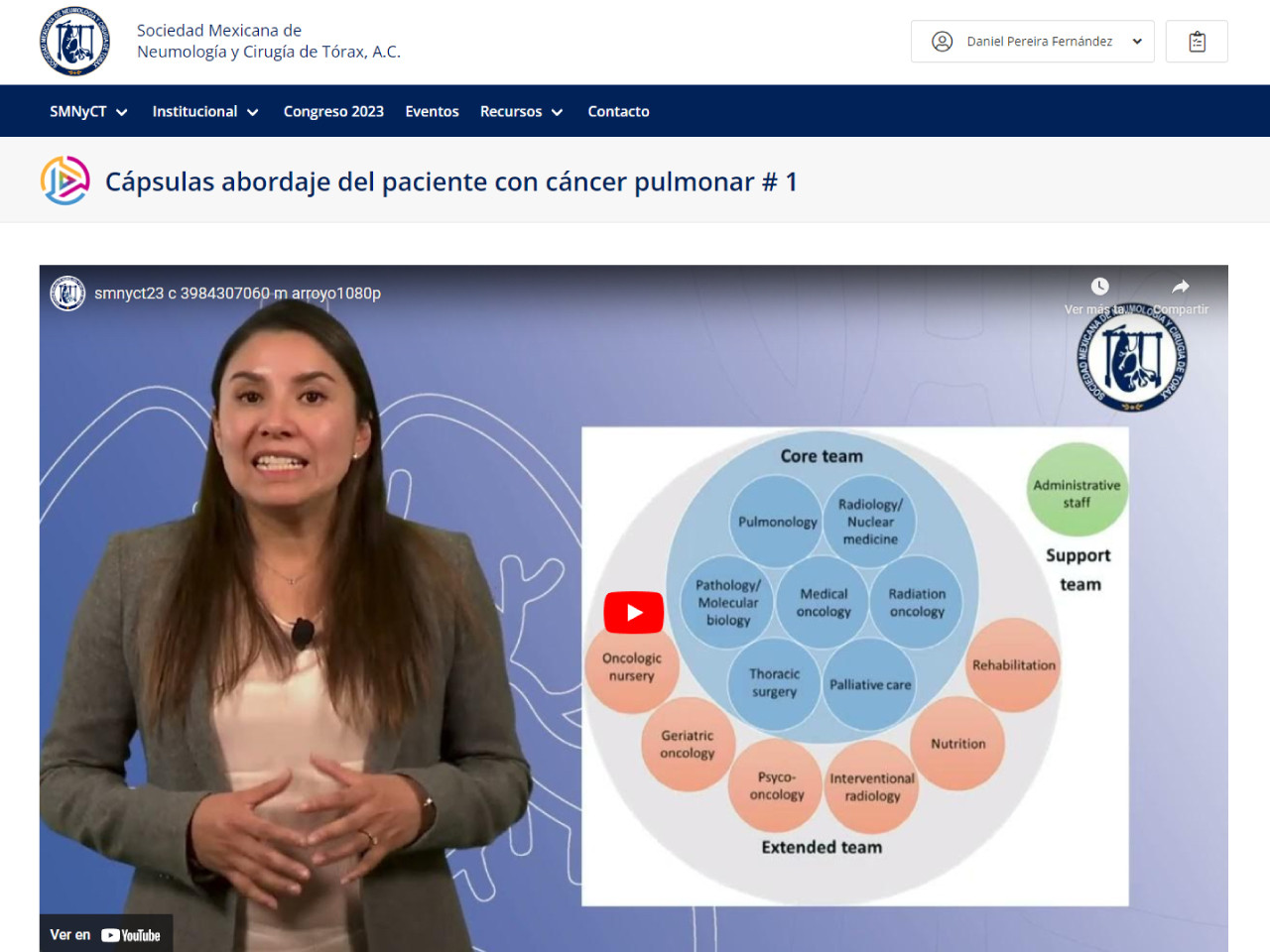Cápsulas # 1. "Importancia del equipo multidisciplinario en cáncer de pulmón"