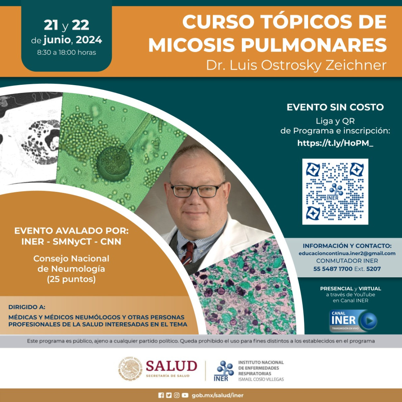 Curso: Micosis pulmonar, día 1