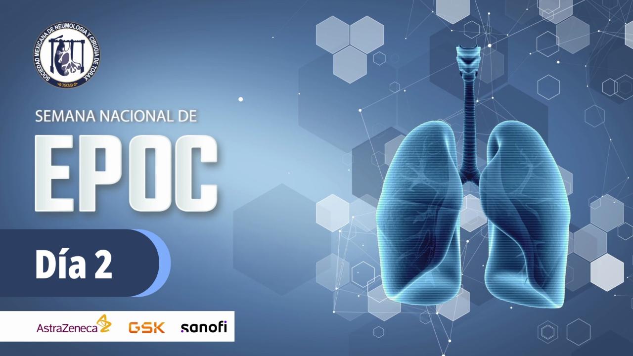Dia 2 - Semana Nacional de EPOC 2025
