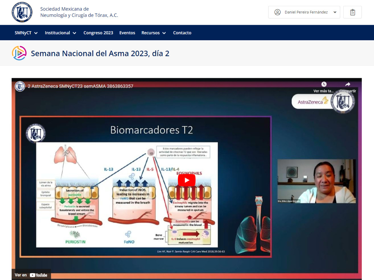 Semana Nacional del Asma 2023, día 2